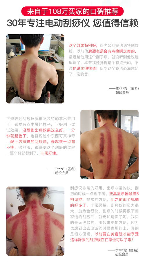 御圣坊家用無線電動刮痧儀 便捷養(yǎng)生，全身適用，限時特惠僅98元